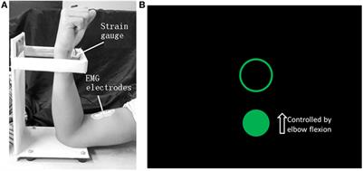 Using Corticomuscular Coherence to Reflect Function Recovery of Paretic Upper Limb after Stroke: A Case Study